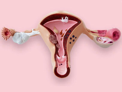 What is premature ovarian insufficiency?